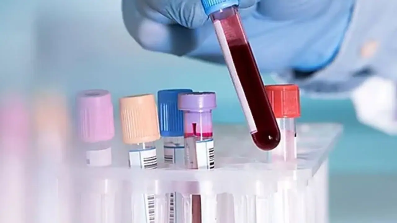 നിത്യജീവിതത്തില് ഇക്കാര്യങ്ങള് ശ്രദ്ധിച്ചില്ലെങ്കില് ക്യാൻസര് സാധ്യത കൂടുതല്... നിത്യജീവിതത്തില് ഇക്കാര്യങ്ങള് ശ്രദ്ധിച്ചില്ലെങ്കില് ക്യാൻസര് സാധ്യത കൂടുതല്...