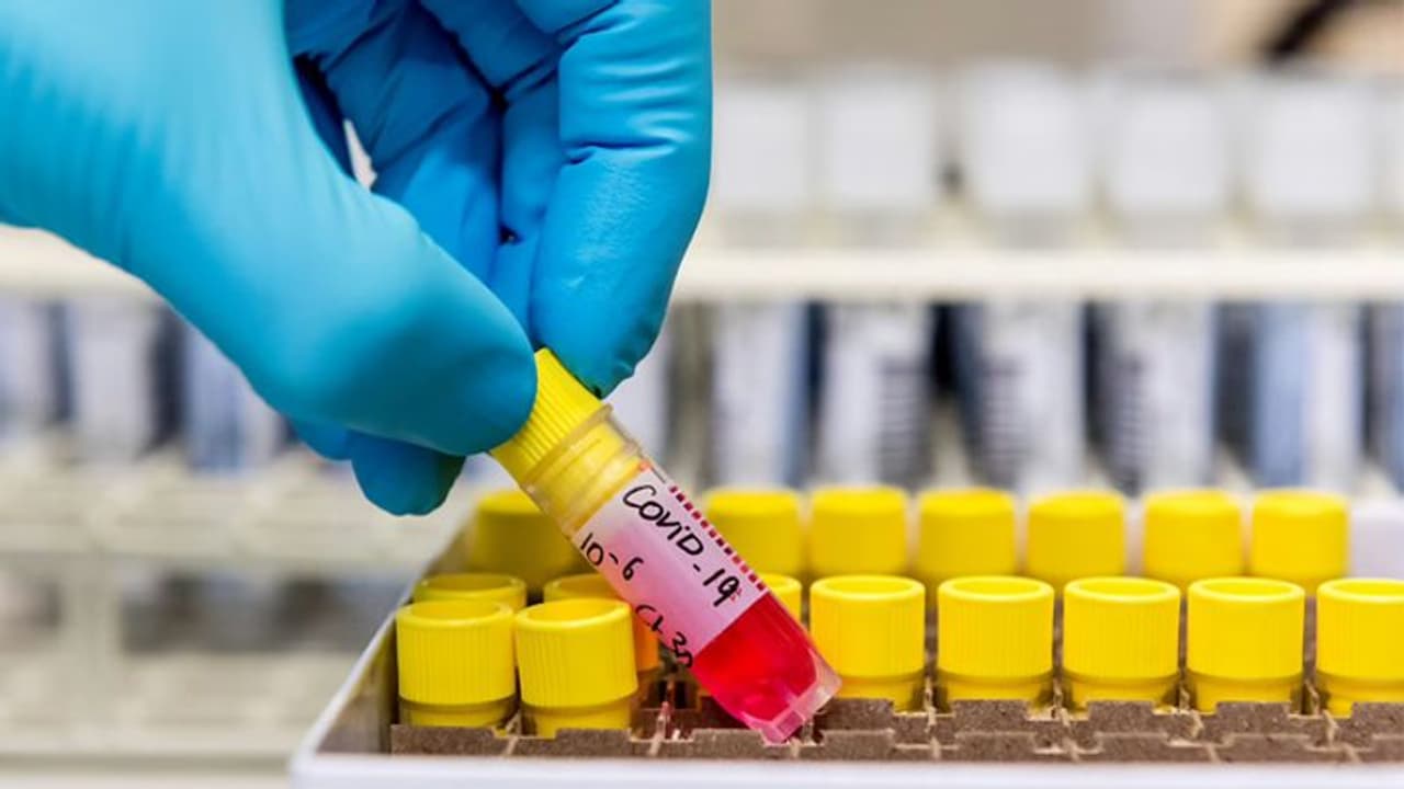 ఏపీలో 5 వేలు దాటిన మరణాలు: 5,83,925కి చేరిన కేసుల సంఖ్య