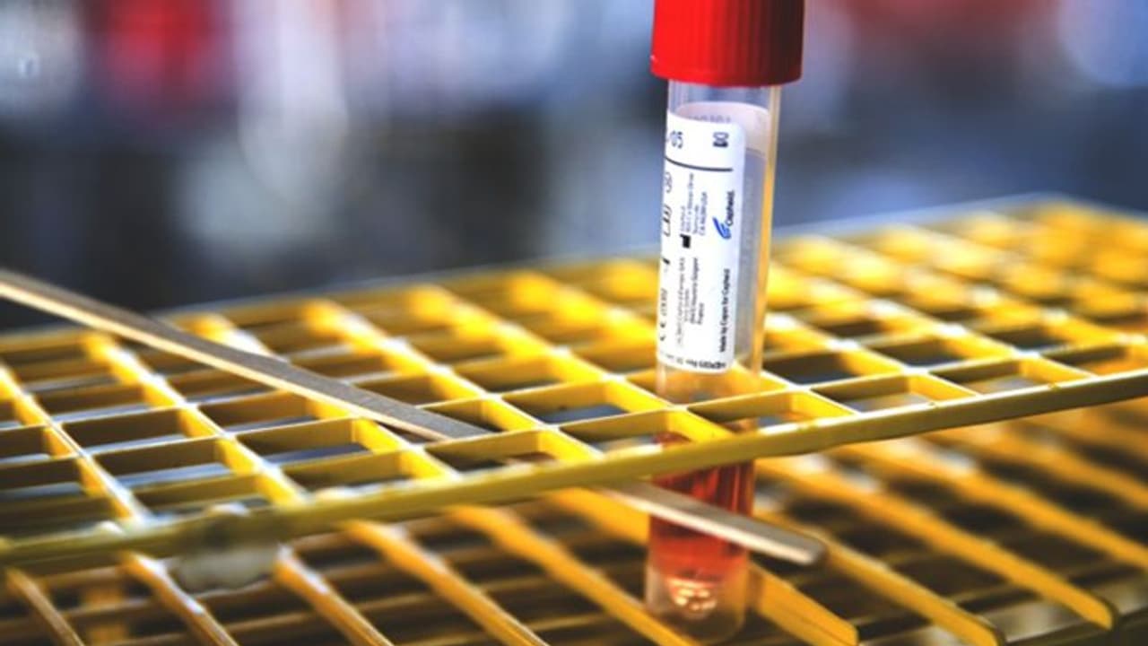 కొత్తగా 4,622 మందికి పాజిటివ్: ఏపీలో 7,63,573కి చేరిన కేసులు కొత్తగా 4,622 మందికి పాజిటివ్: ఏపీలో 7,63,573కి చేరిన కేసులు