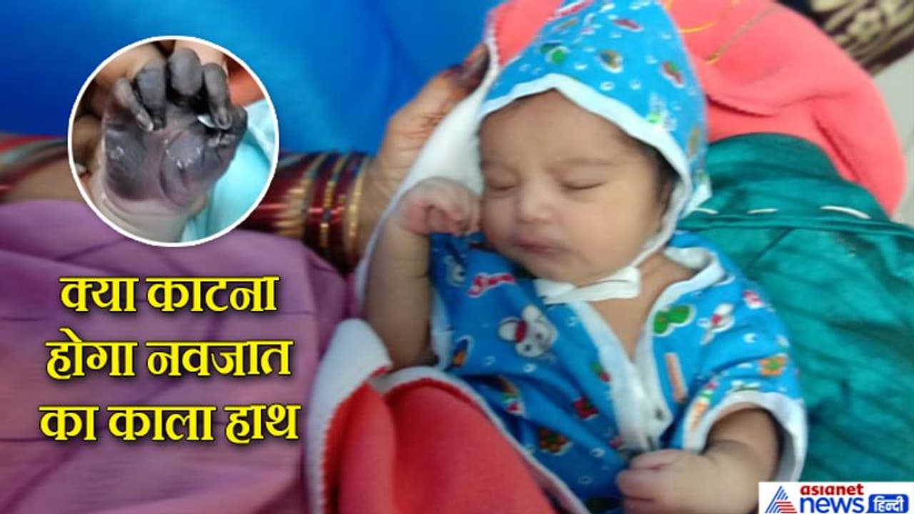 टीका लगते ही नवजात को आया बुखार और फिर काला पड़ता गया हाथ, अगर हाथ काटना पड़ा, तो कौन जिम्मेदार? टीका लगते ही नवजात को आया बुखार और फिर काला पड़ता गया हाथ, अगर हाथ काटना पड़ा, तो कौन जिम्मेदार?