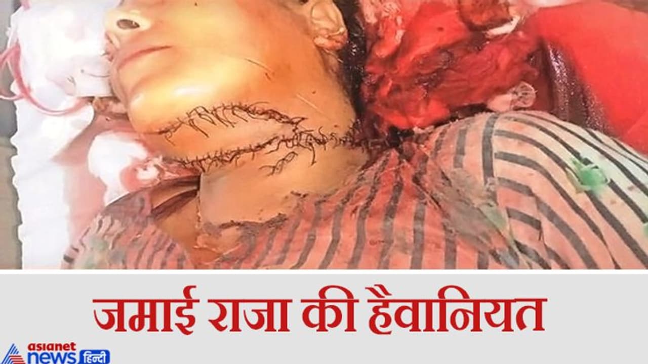 झाड़ियों में छुपकर बैठा था दामाद, जैसे ही निकली सास...पकड़ लिया हाथ और फिर कर दिया यह हाल झाड़ियों में छुपकर बैठा था दामाद, जैसे ही निकली सास...पकड़ लिया हाथ और फिर कर दिया यह हाल