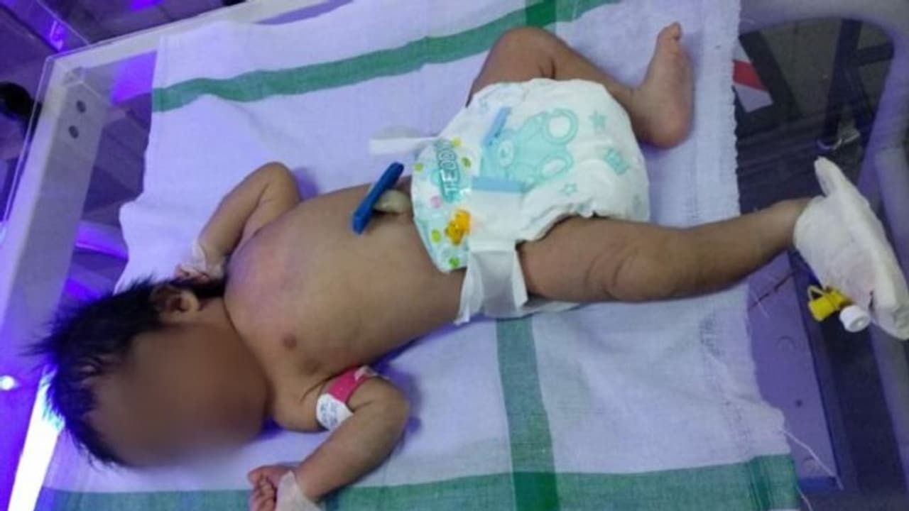 ಪ್ಲಾಸ್ಟಿಕ್ ಕವರ್ನಲ್ಲಿ ನವಜಾತ ಗಂಡು ಮಗು ಪತ್ತೆ: ರಕ್ಷಣೆ ಮಾಡಿದ ಶಿವಮೊಗ್ಗ ಆರೋಗ್ಯ ಇಲಾಖೆ ಪ್ಲಾಸ್ಟಿಕ್ ಕವರ್ನಲ್ಲಿ ನವಜಾತ ಗಂಡು ಮಗು ಪತ್ತೆ: ರಕ್ಷಣೆ ಮಾಡಿದ ಶಿವಮೊಗ್ಗ ಆರೋಗ್ಯ ಇಲಾಖೆ