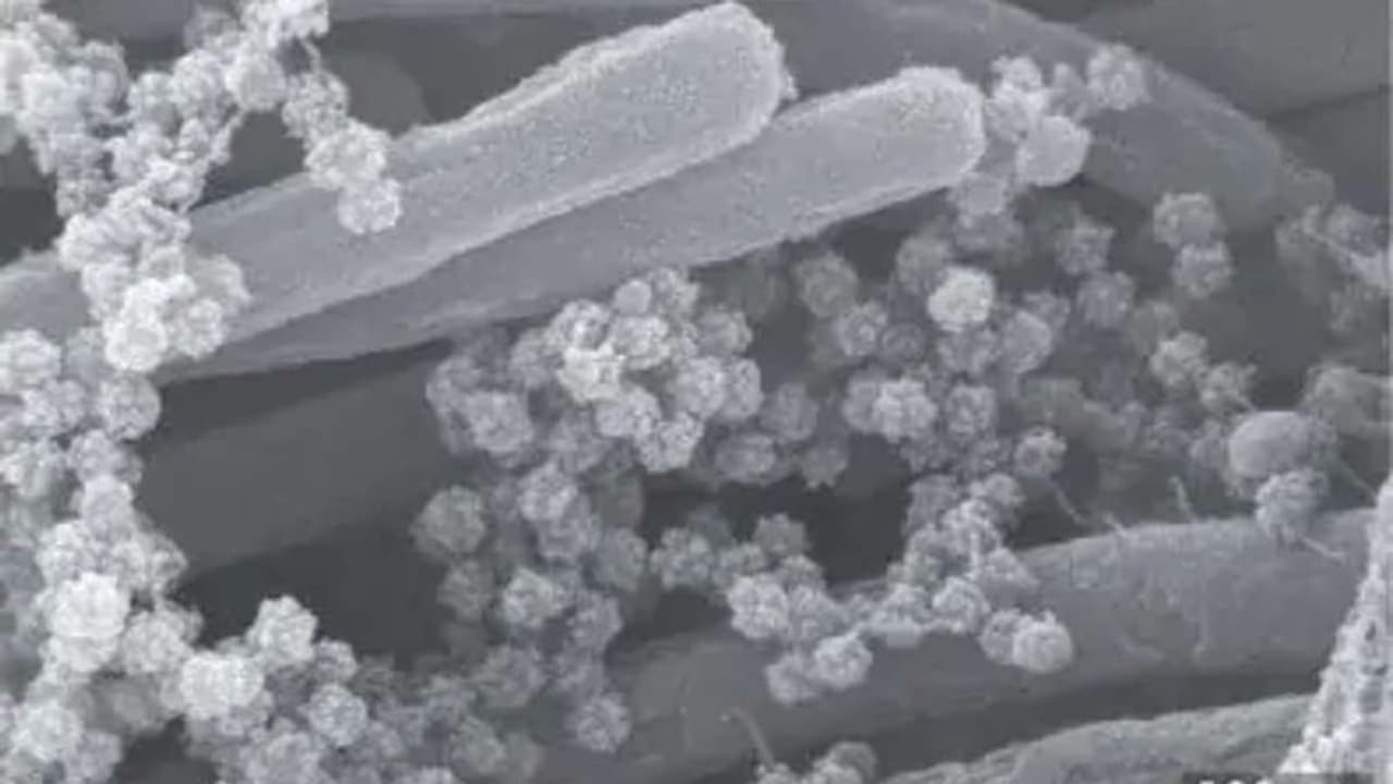 ஆண்களின் ஆண்மைக்கு ஆபத்து..! அடுத்தடுத்து அட்டாக் பண்ணும் வைரஸ் நோய்.! ஆண்களின் ஆண்மைக்கு ஆபத்து..! அடுத்தடுத்து அட்டாக் பண்ணும் வைரஸ் நோய்.!