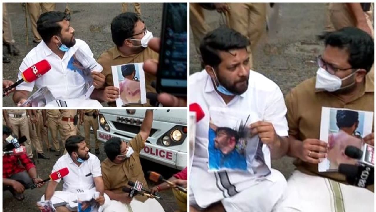 പരിക്കേറ്റവരുടെ ചിത്രങ്ങളുമായി ഷാഫിയും ശബരീനാഥനും, റോഡിൽ കുത്തിയിരുന്ന് പ്രതിഷേധം, നാടകീയ രംഗങ്ങൾ, അറസ്റ്റ് പരിക്കേറ്റവരുടെ ചിത്രങ്ങളുമായി ഷാഫിയും ശബരീനാഥനും, റോഡിൽ കുത്തിയിരുന്ന് പ്രതിഷേധം, നാടകീയ രംഗങ്ങൾ, അറസ്റ്റ്