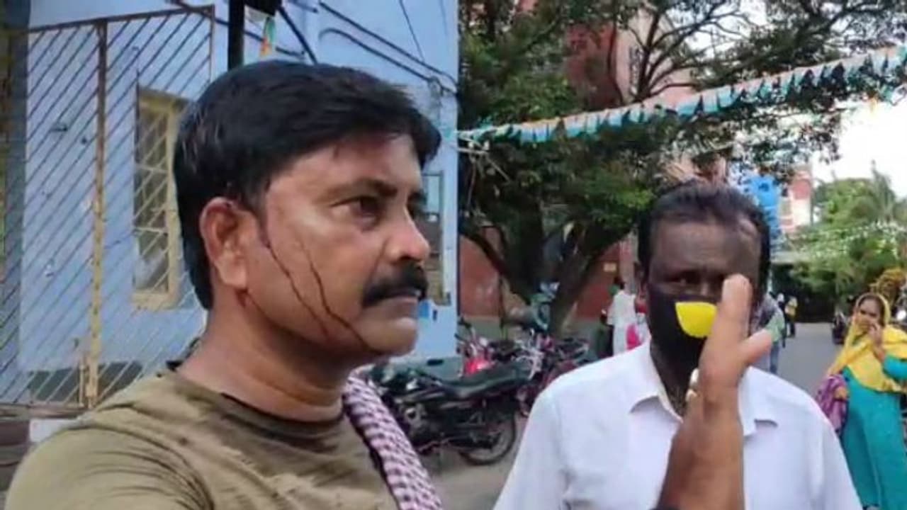 'মাস্ক পরেননি কেন', হাসপাতালরক্ষীর 'মারে' মাথা ফাটল রোগীর আত্মীয়র 'মাস্ক পরেননি কেন', হাসপাতালরক্ষীর 'মারে' মাথা ফাটল রোগীর আত্মীয়র