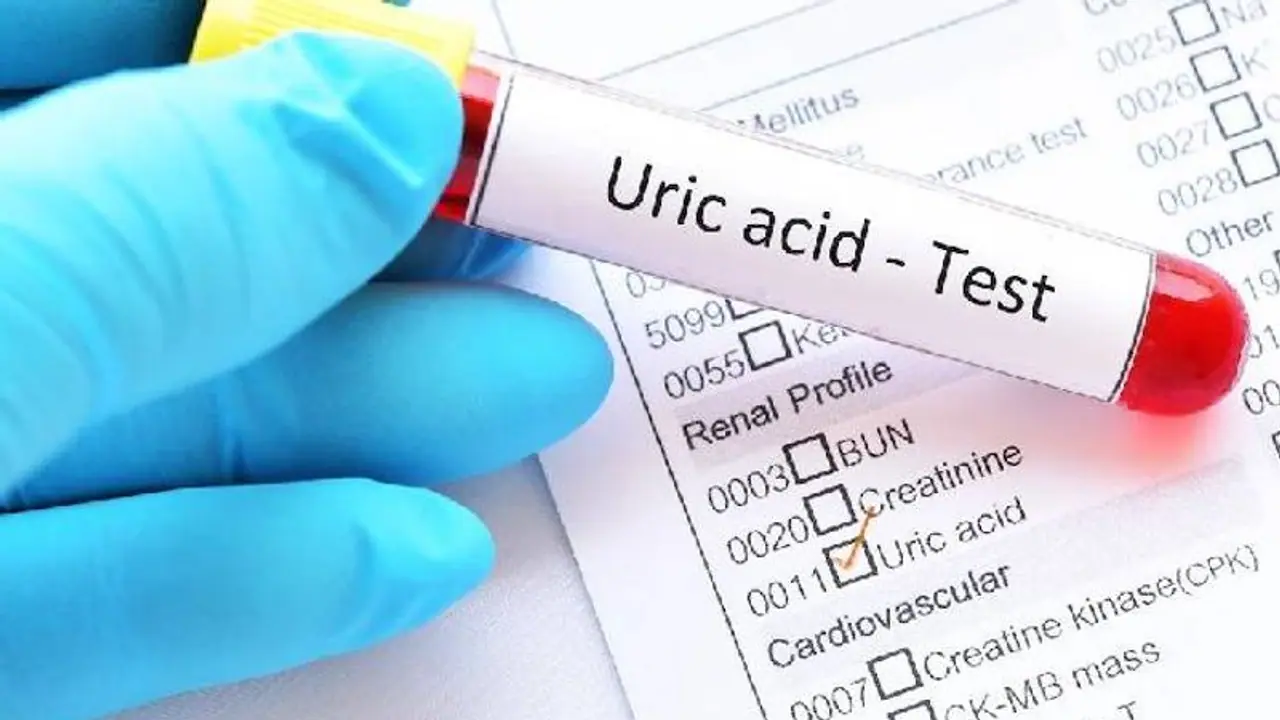 அளவுக்கு மீறினால் கால்களை பதம் பார்க்கும் யூரிக் அமிலம் கவனம் இருக்கட்டும்..!! அளவுக்கு மீறினால் கால்களை பதம் பார்க்கும் யூரிக் அமிலம் கவனம் இருக்கட்டும்..!!