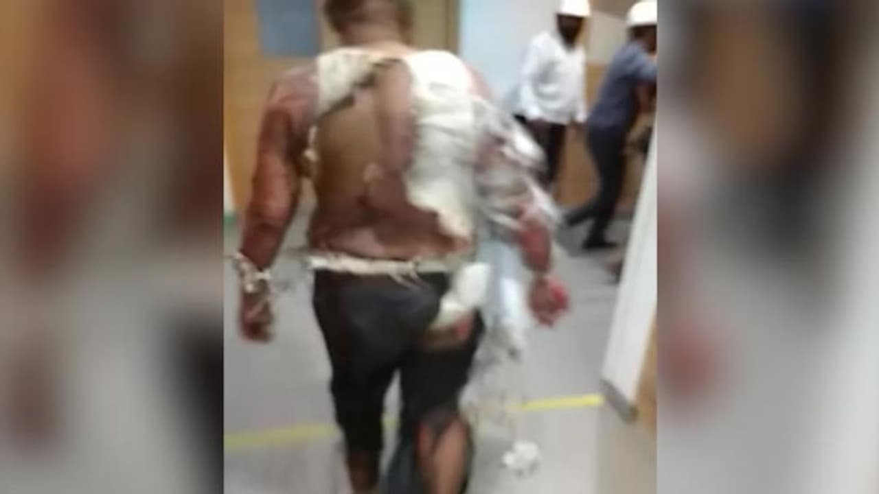 Bengaluru: Two critically injured after fire accident in KPTCL plant