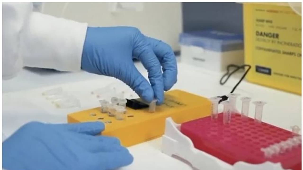 സ്മാര്ട്ട് ഫോണിന്റെ വലിപ്പത്തില് പോര്ട്ടബിള് കൊവിഡ് പരിശോധനാ കിറ്റ്; ഫലം 45 മിനിറ്റിനുള്ളില് സ്മാര്ട്ട് ഫോണിന്റെ വലിപ്പത്തില് പോര്ട്ടബിള് കൊവിഡ് പരിശോധനാ കിറ്റ്; ഫലം 45 മിനിറ്റിനുള്ളില്