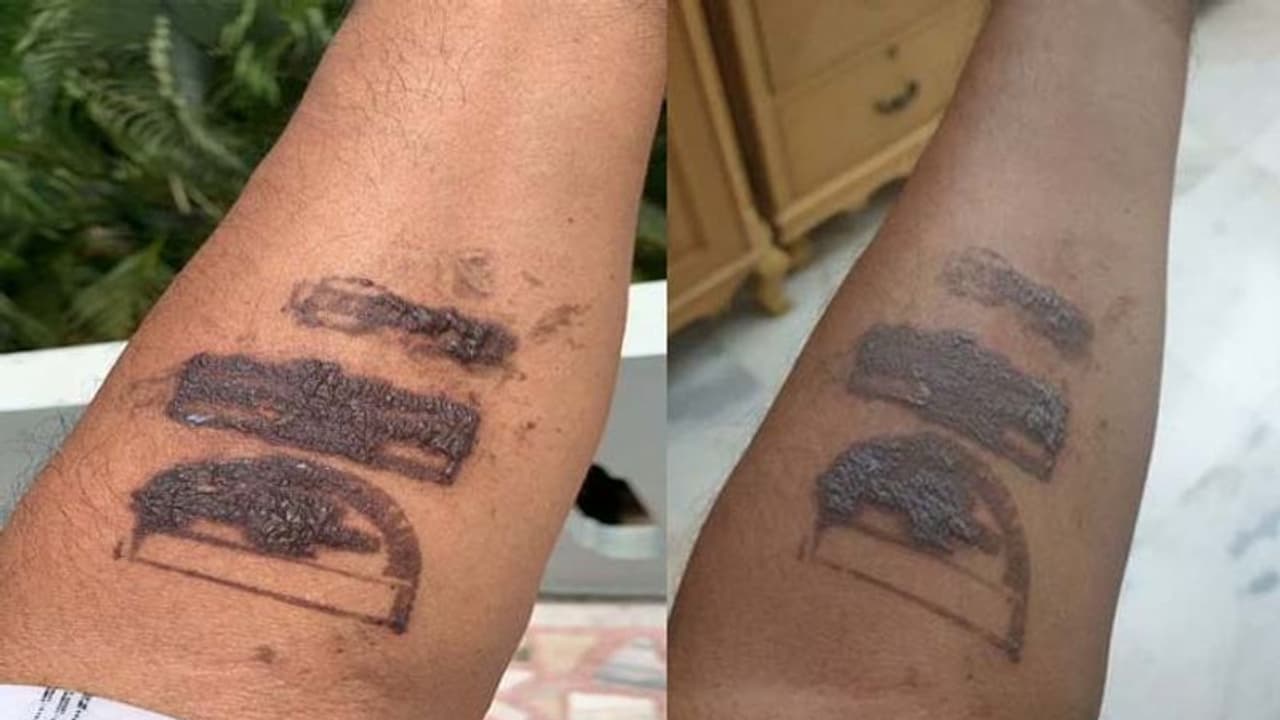 మీ వల్ల నా చేయి పరిస్థితి చూడండి: కేంద్ర మంత్రిని నిలదీసిన మధుయాష్కి