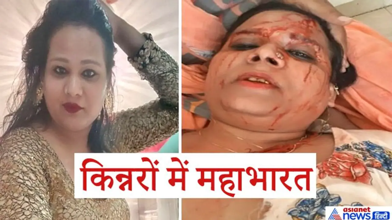 किन्नरों में महाभारत: राजीनामे के लिए बुलाकर पहले बाल काटे और फिर कैंची घोंपी किन्नरों में महाभारत: राजीनामे के लिए बुलाकर पहले बाल काटे और फिर कैंची घोंपी