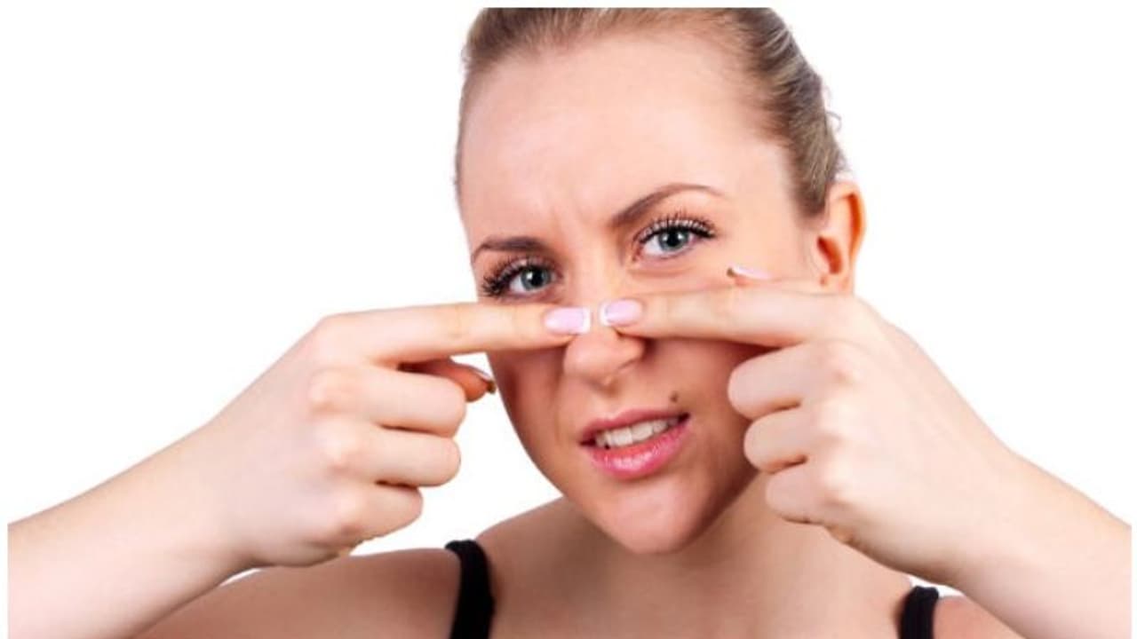 How to remove black heads using home remedies