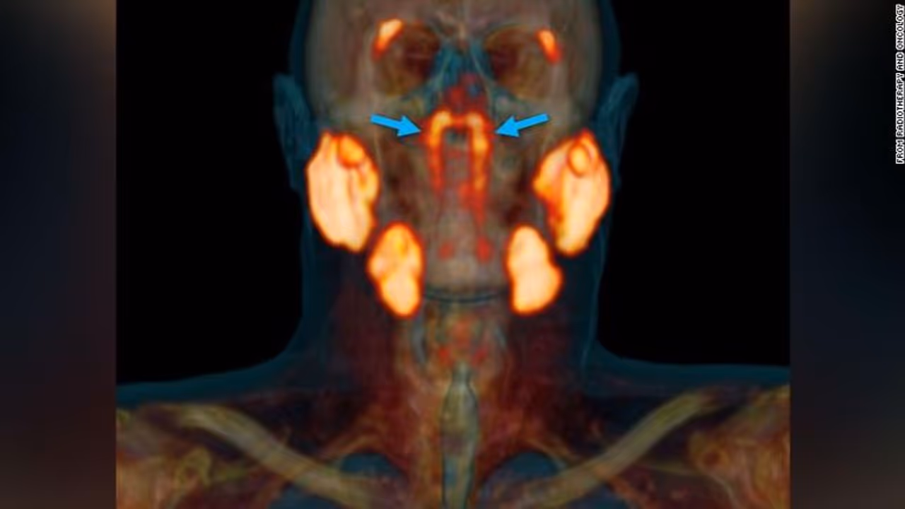 മനുഷ്യ ശരീരത്തില് പുതിയ ഒരു അവയവം കൂടി കണ്ടെത്തി മനുഷ്യ ശരീരത്തില് പുതിയ ഒരു അവയവം കൂടി കണ്ടെത്തി