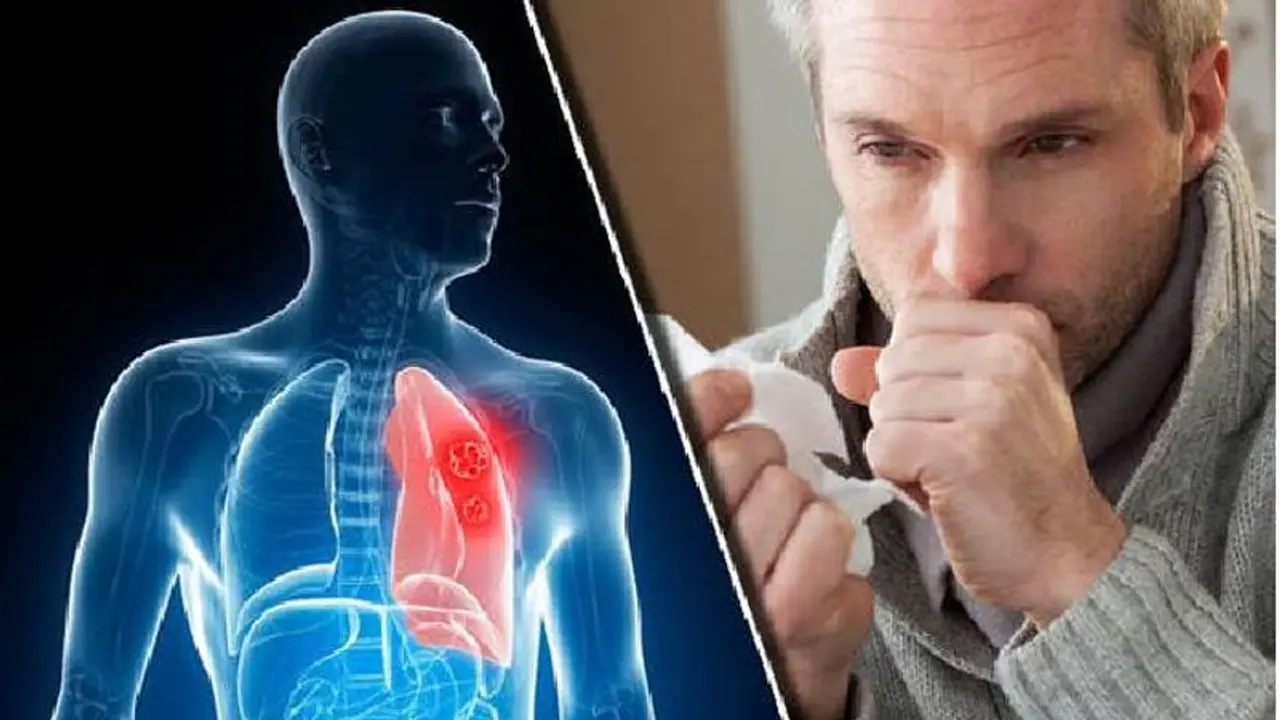 দূষণের হাত থেকে ফুসফুস পরিশুদ্ধ ও সুস্থ রাখতে পাতে রাখুন এই ৫ জিনিস দূষণের হাত থেকে ফুসফুস পরিশুদ্ধ ও সুস্থ রাখতে পাতে রাখুন এই ৫ জিনিস