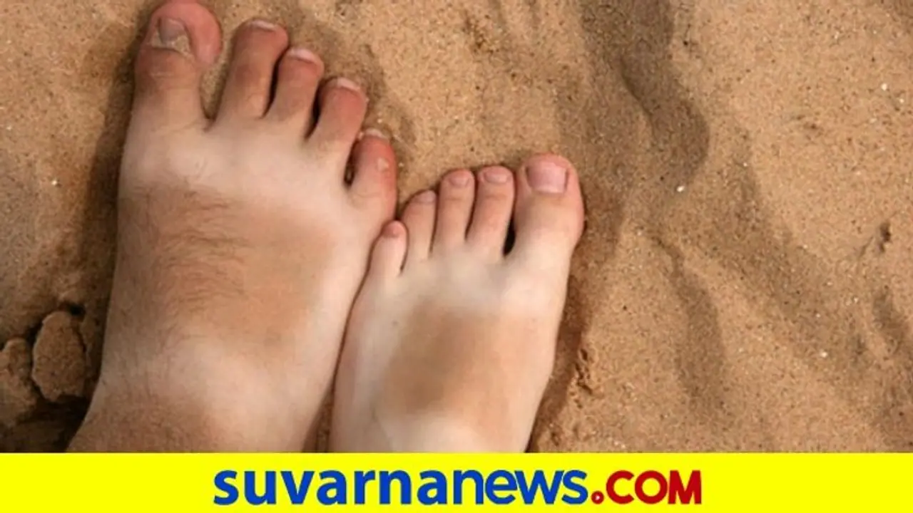 From tomato to cucumber; 5 easy yet effective home remedies to remove sun tan