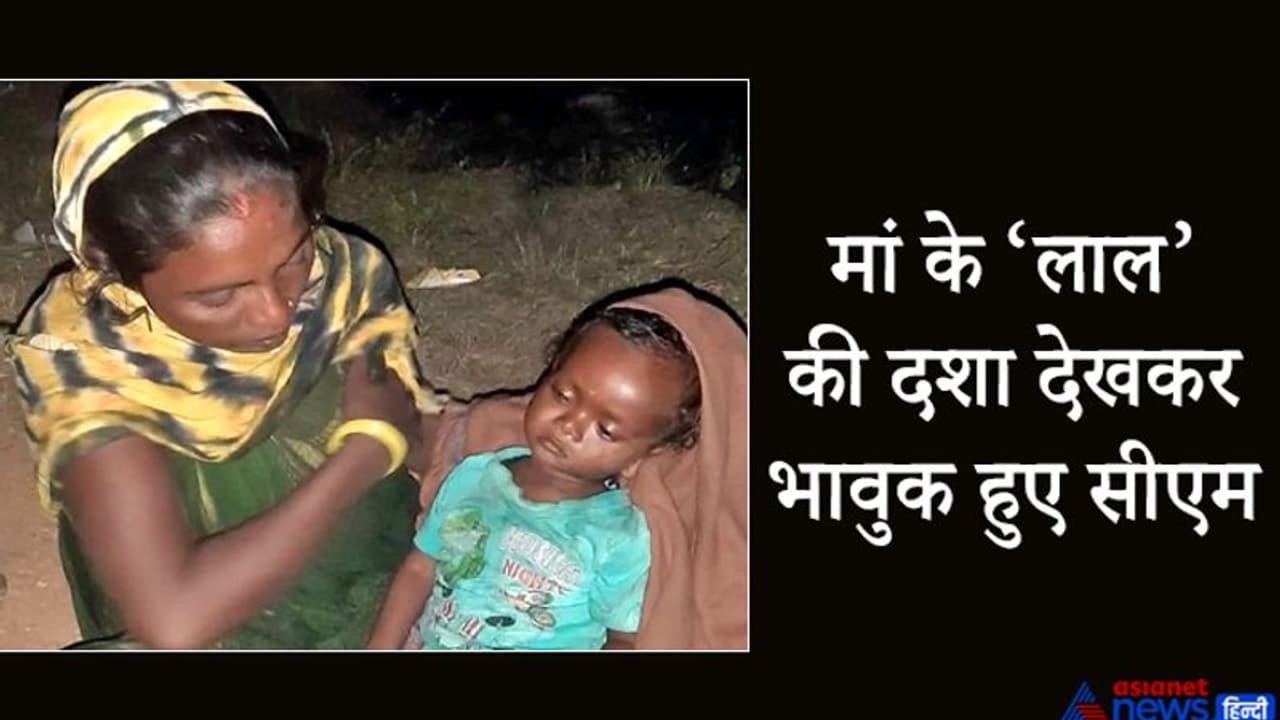 अपने मासूम बेटे को तिल तिल मरते देखकर रोये जा रहे थे मां बाप, CM हुए भावुक