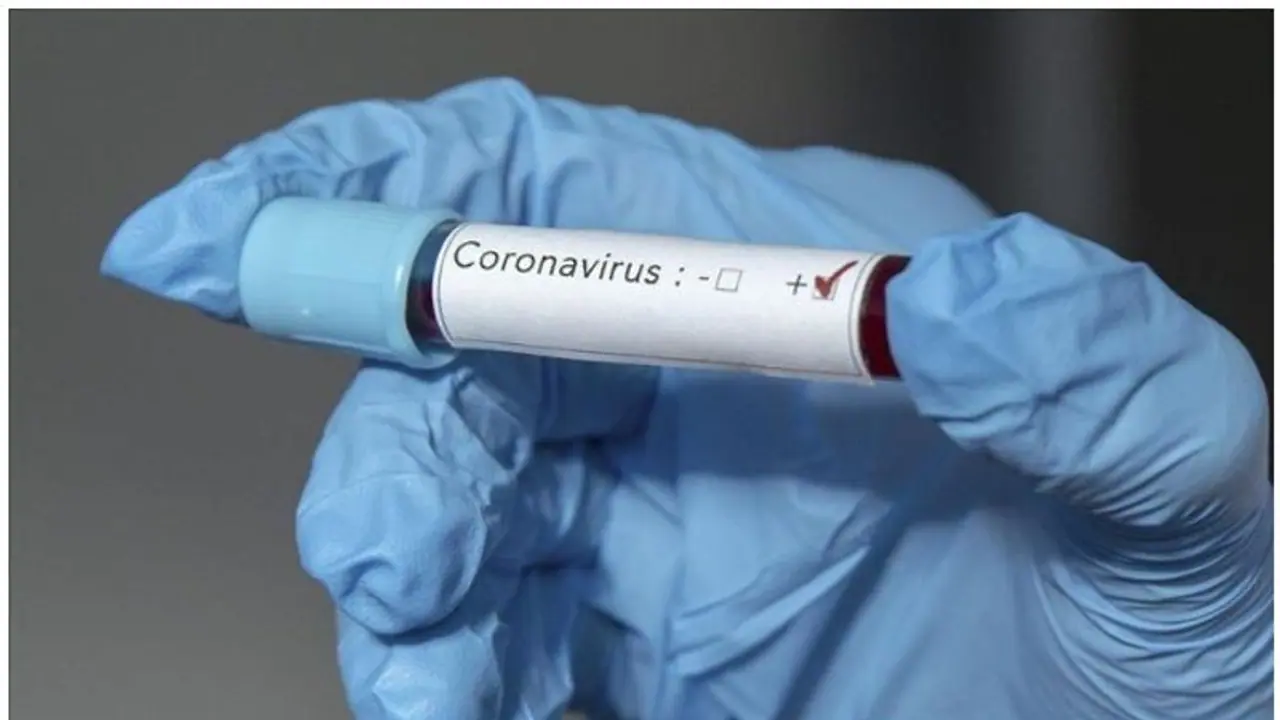 കൊവിഡിനെ നിസാരമായി കാണരുതേ, അറിയേണ്ട ചില കാര്യങ്ങൾ