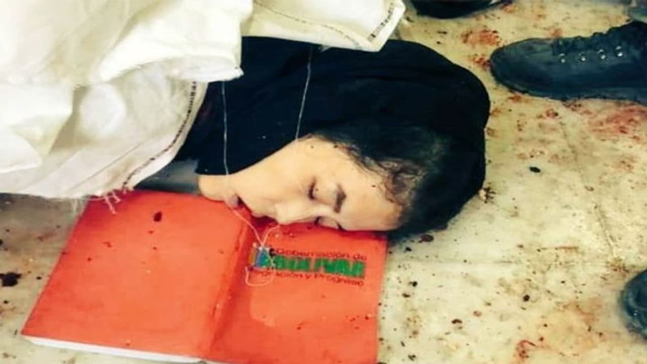 अफगानिस्तान की काबुल यूनिवर्सिटी में आतंकी हमले में 25 की मौत, निहत्थे छात्रों पर आतंकियों ने बरसाईं गोलियां अफगानिस्तान की काबुल यूनिवर्सिटी में आतंकी हमले में 25 की मौत, निहत्थे छात्रों पर आतंकियों ने बरसाईं गोलियां