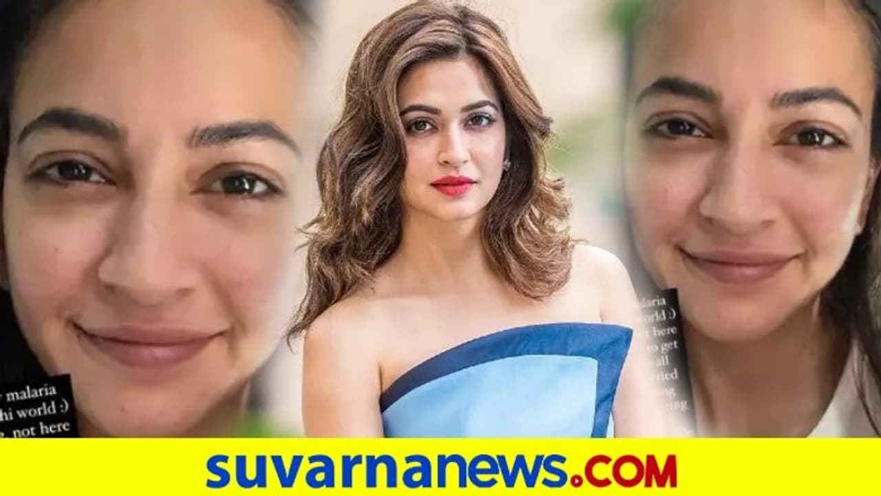 ಮಲೇರಿಯಾದಿಂದ ಮುಖ ಹೇಗಾಗಿದೆ ನೋಡಿ; ನಟಿ ಕೃತಿ ಫೋಟೋ ವೈರಲ್!