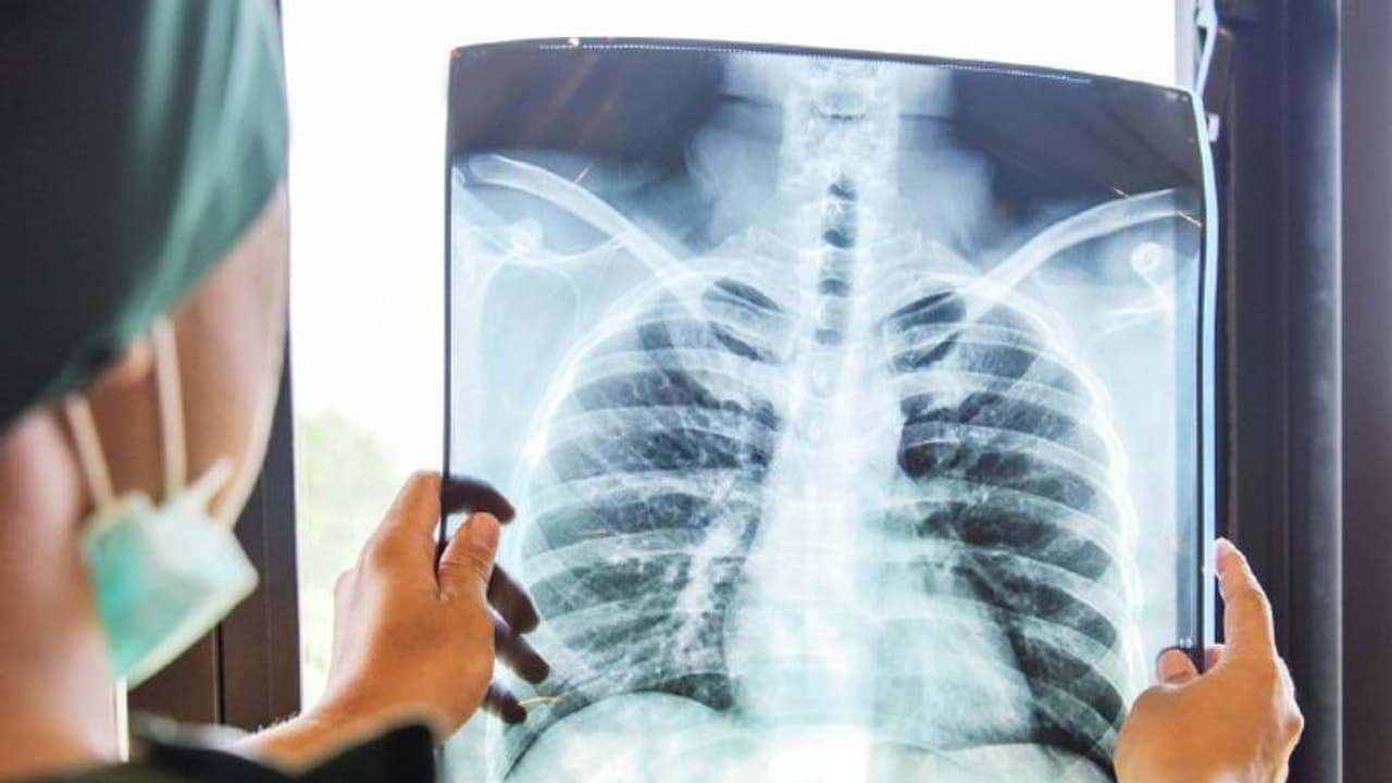 World Pneumonia Day 2021 শুধু শিশুরাই নয়, বর্তমানে এই রোগের হাত থেকে রেহাই নেই প্রাপ্তবয়স্কদেরও World Pneumonia Day 2021 শুধু শিশুরাই নয়, বর্তমানে এই রোগের হাত থেকে রেহাই নেই প্রাপ্তবয়স্কদেরও