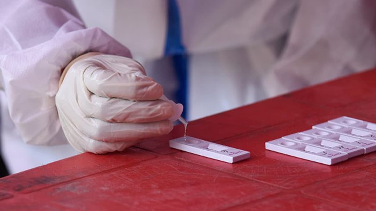 സംസ്ഥാനത്ത് ഇന്ന് 6419 പേർക്ക് കൊവിഡ്, 7066 പേർ രോഗമുക്തി നേടി, 28 മരണം സംസ്ഥാനത്ത് ഇന്ന് 6419 പേർക്ക് കൊവിഡ്, 7066 പേർ രോഗമുക്തി നേടി, 28 മരണം