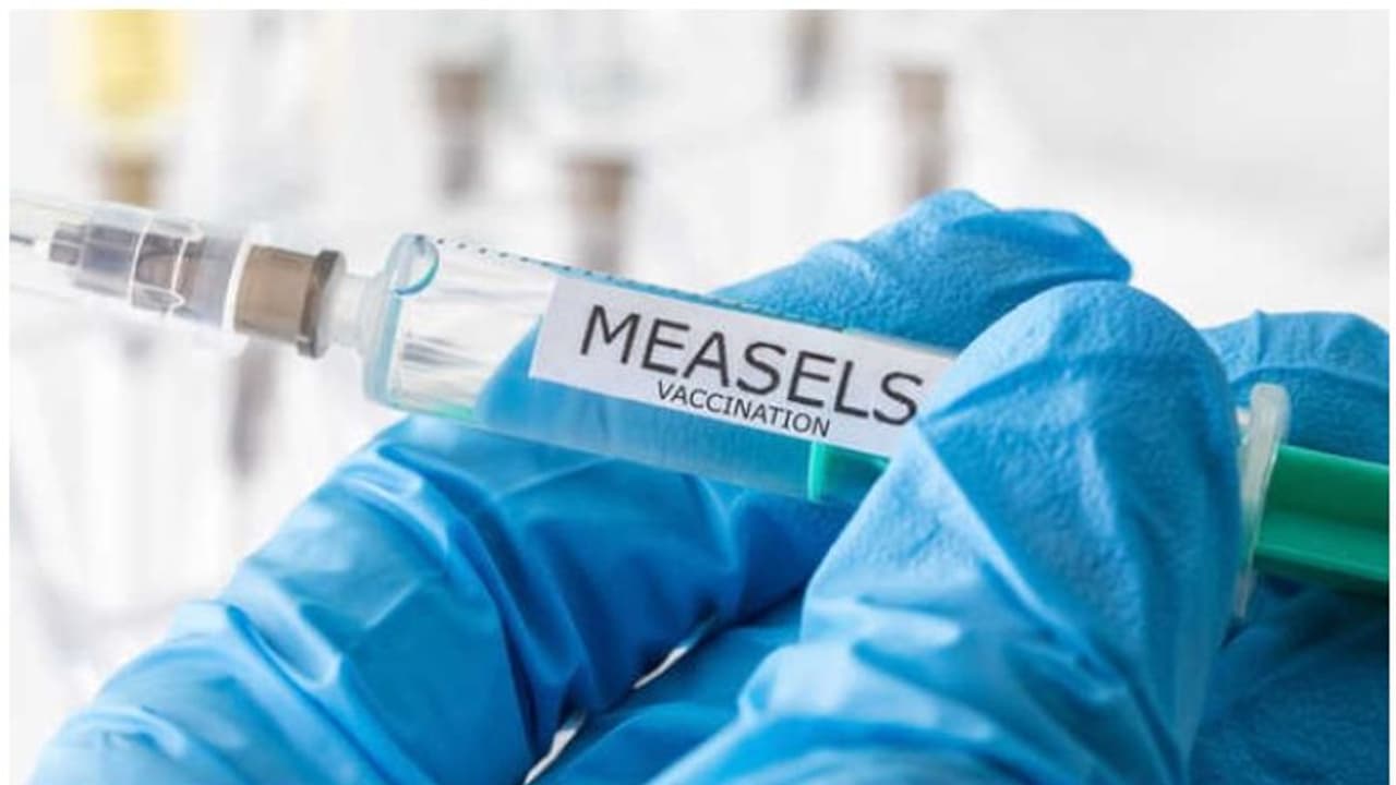 2021ൽ അഞ്ചാംപനി പൊട്ടിപ്പുറപ്പെടാൻ സാധ്യതയെന്ന് പഠനം