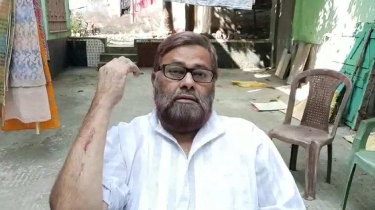 বিজেপিতে যোগদানের 'মাশুল', বীরভূমের আক্রান্ত দলের সংখ্যালঘু সেলের পদাধিকারী বিজেপিতে যোগদানের 'মাশুল', বীরভূমের আক্রান্ত দলের সংখ্যালঘু সেলের পদাধিকারী