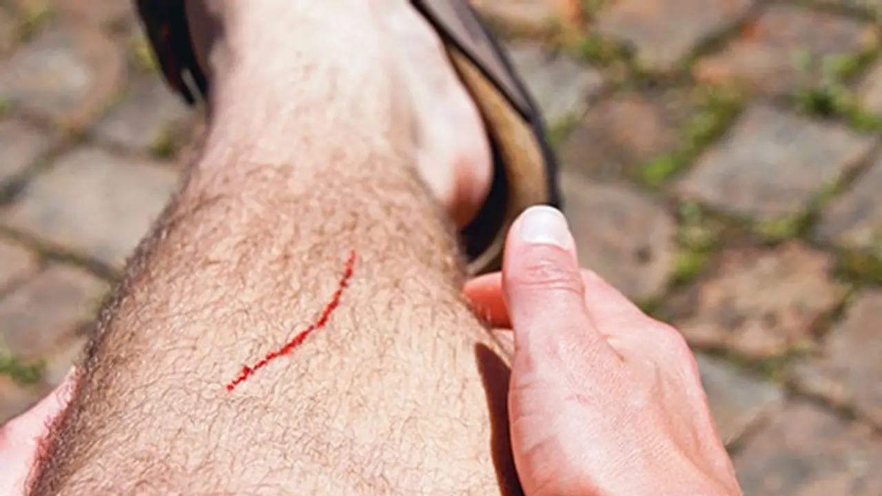 గద్వాల జిల్లాలో దారుణం.. గాయాలకు కుట్లకు బదులు ఫెవీక్విక్ తో అతుకులు.. ! గద్వాల జిల్లాలో దారుణం.. గాయాలకు కుట్లకు బదులు ఫెవీక్విక్ తో అతుకులు.. !