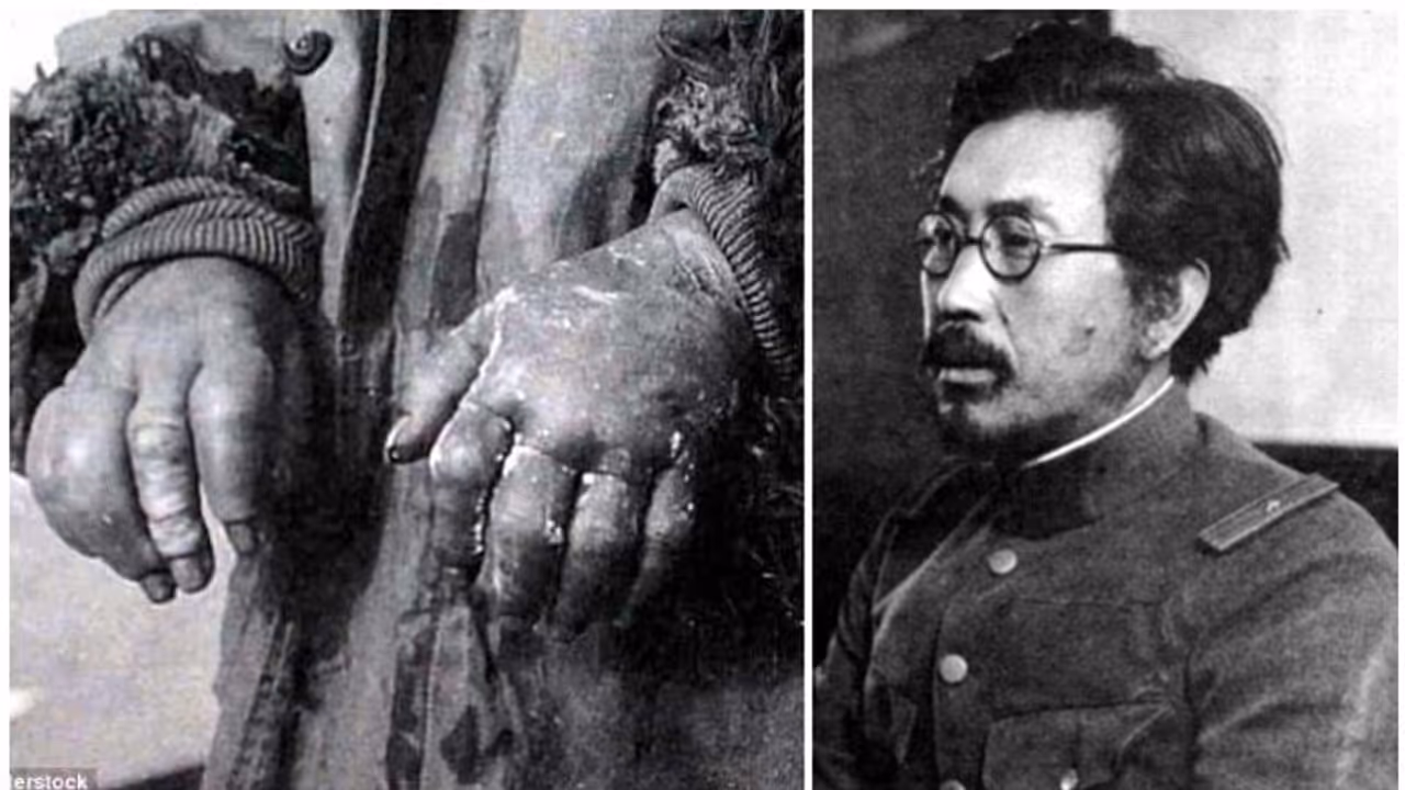 കോൺസൻട്രേഷൻ ക്യാമ്പ് ഒന്നുമല്ല, ഈ ജാപ്പനീസ് ഡോക്ടർ തടവുകാരെ വിധേയരാക്കിയത് നാസികളെ വെല്ലുന്ന ക്രൂരതകൾക്ക് കോൺസൻട്രേഷൻ ക്യാമ്പ് ഒന്നുമല്ല, ഈ ജാപ്പനീസ് ഡോക്ടർ തടവുകാരെ വിധേയരാക്കിയത് നാസികളെ വെല്ലുന്ന ക്രൂരതകൾക്ക്