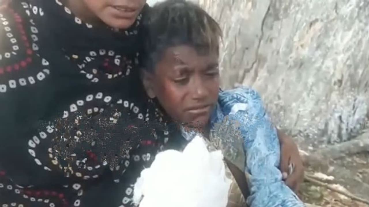 আবর্জনার স্তূপ থেকে আচমকা বিস্ফোরণ, কাগজ কুড়োতে গিয়ে ছিন্নভিন্ন নাবালকের হাত আবর্জনার স্তূপ থেকে আচমকা বিস্ফোরণ, কাগজ কুড়োতে গিয়ে ছিন্নভিন্ন নাবালকের হাত