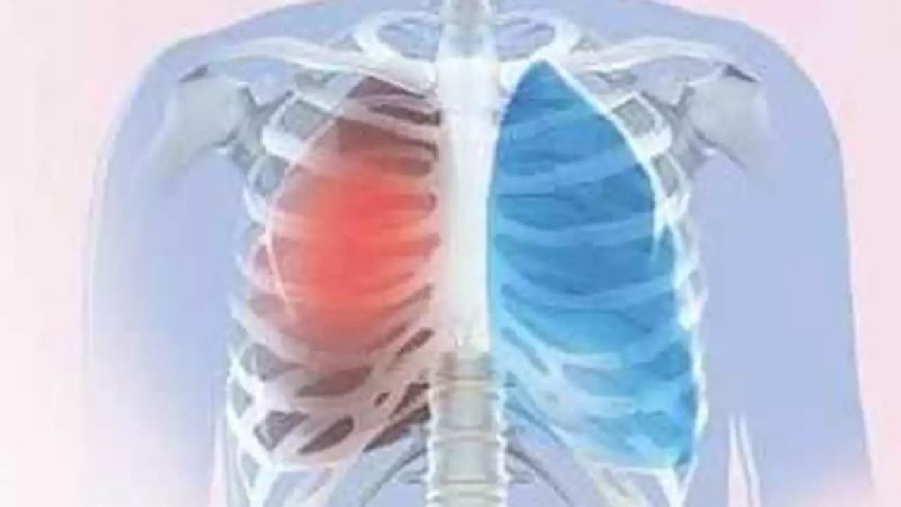 पहली बार: दिल्ली में कोविड के मरीज का लंग ट्रांसप्लांट, 10 घंटे की सर्जरी के बाद मरीज को मिली नई जिंदगी पहली बार: दिल्ली में कोविड के मरीज का लंग ट्रांसप्लांट, 10 घंटे की सर्जरी के बाद मरीज को मिली नई जिंदगी