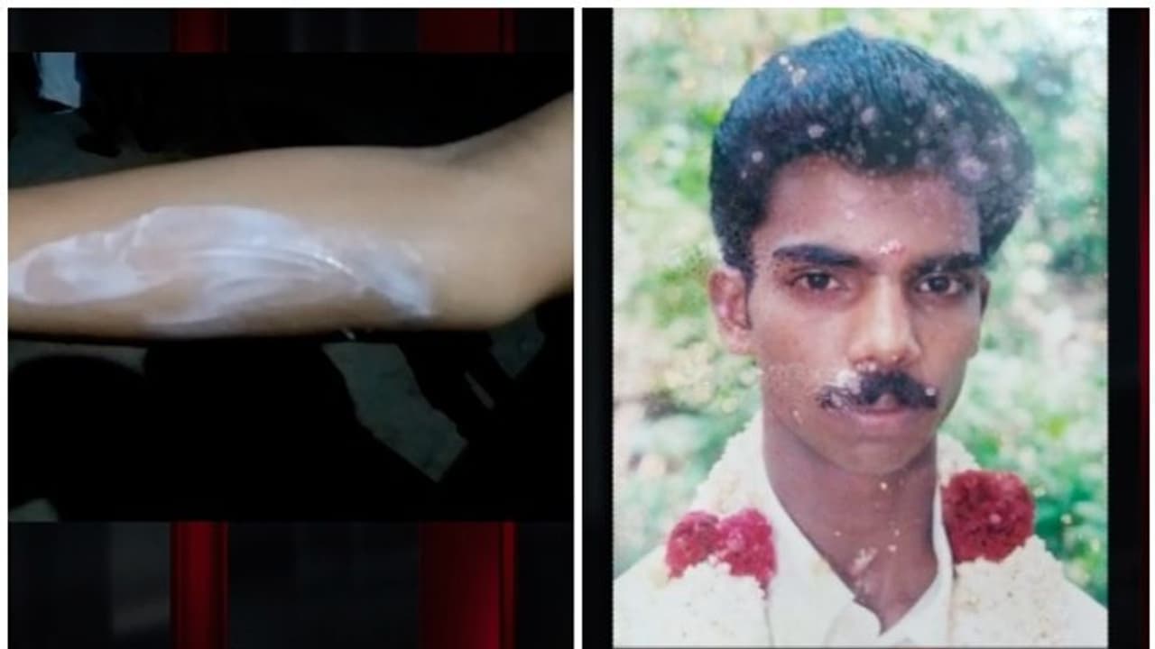 ഭാര്യയ്ക്കും മകള്ക്കും നേരെ ആസിഡ് ആക്രമണം; യുവാവിനെ പൊലീസ് തിരയുന്നു ഭാര്യയ്ക്കും മകള്ക്കും നേരെ ആസിഡ് ആക്രമണം; യുവാവിനെ പൊലീസ് തിരയുന്നു