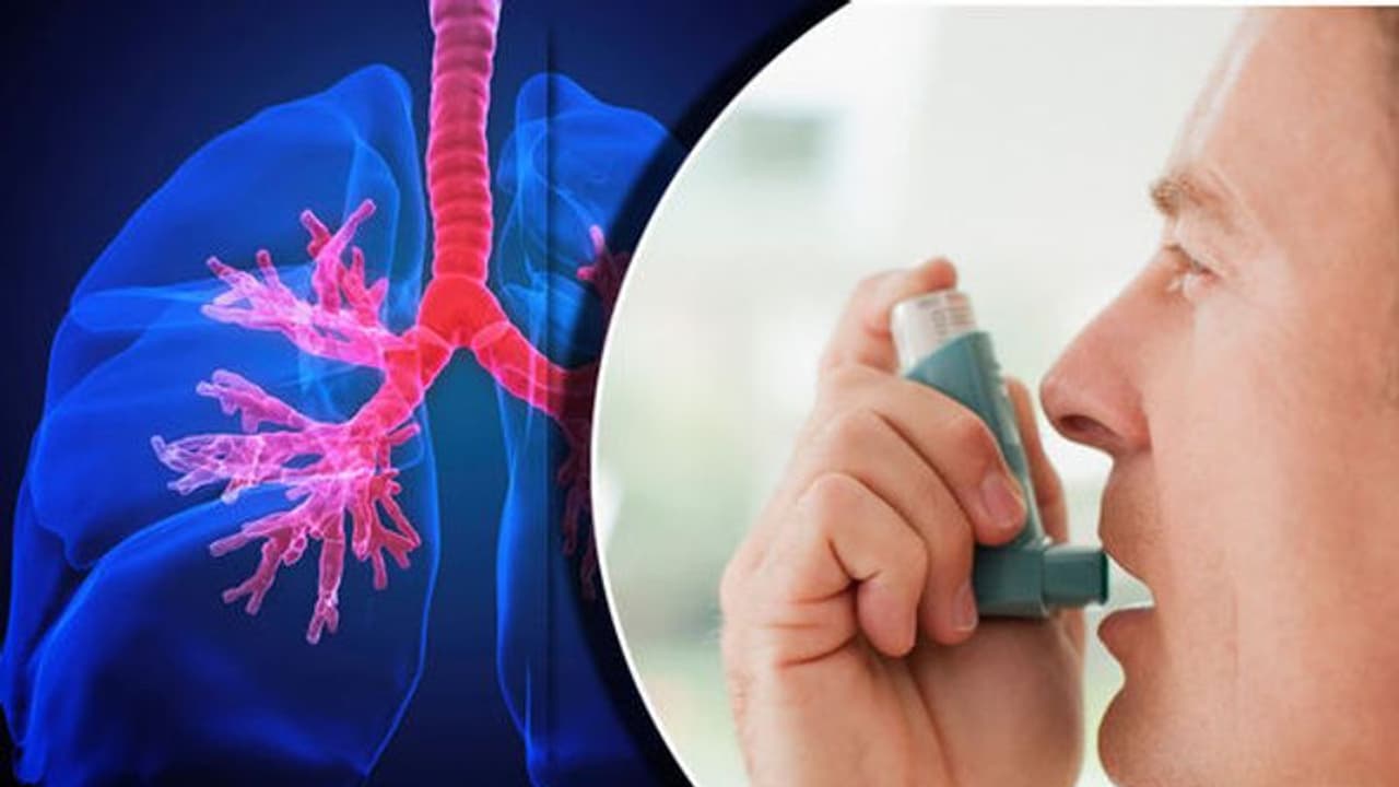 ആസ്ത്മയുള്ളവരുടെ ശ്രദ്ധയ്ക്ക്; ഒഴിവാക്കേണ്ട ചില ഭക്ഷണങ്ങൾ ആസ്ത്മയുള്ളവരുടെ ശ്രദ്ധയ്ക്ക്; ഒഴിവാക്കേണ്ട ചില ഭക്ഷണങ്ങൾ