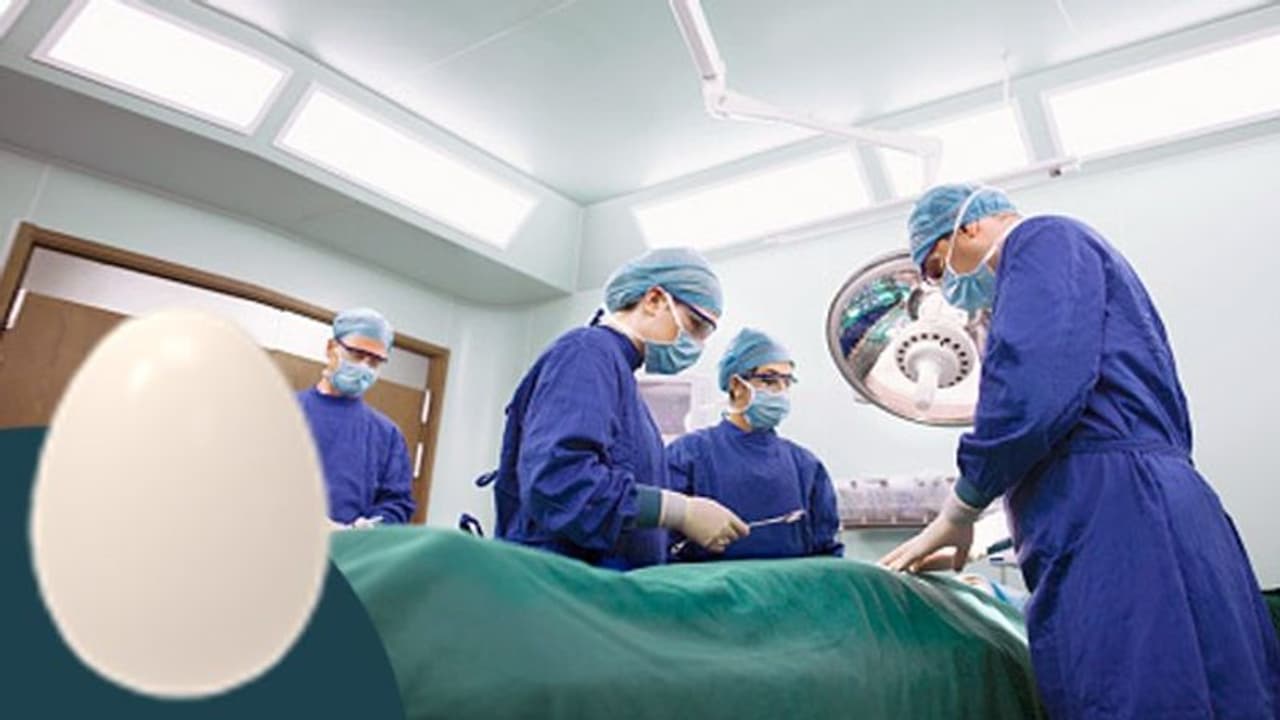 টিউমার ভেবে অস্ত্রোপচার করতে গিয়ে বেরোল সেদ্ধ ডিম, অবাক আরজি করের চিকিৎসকেরাও