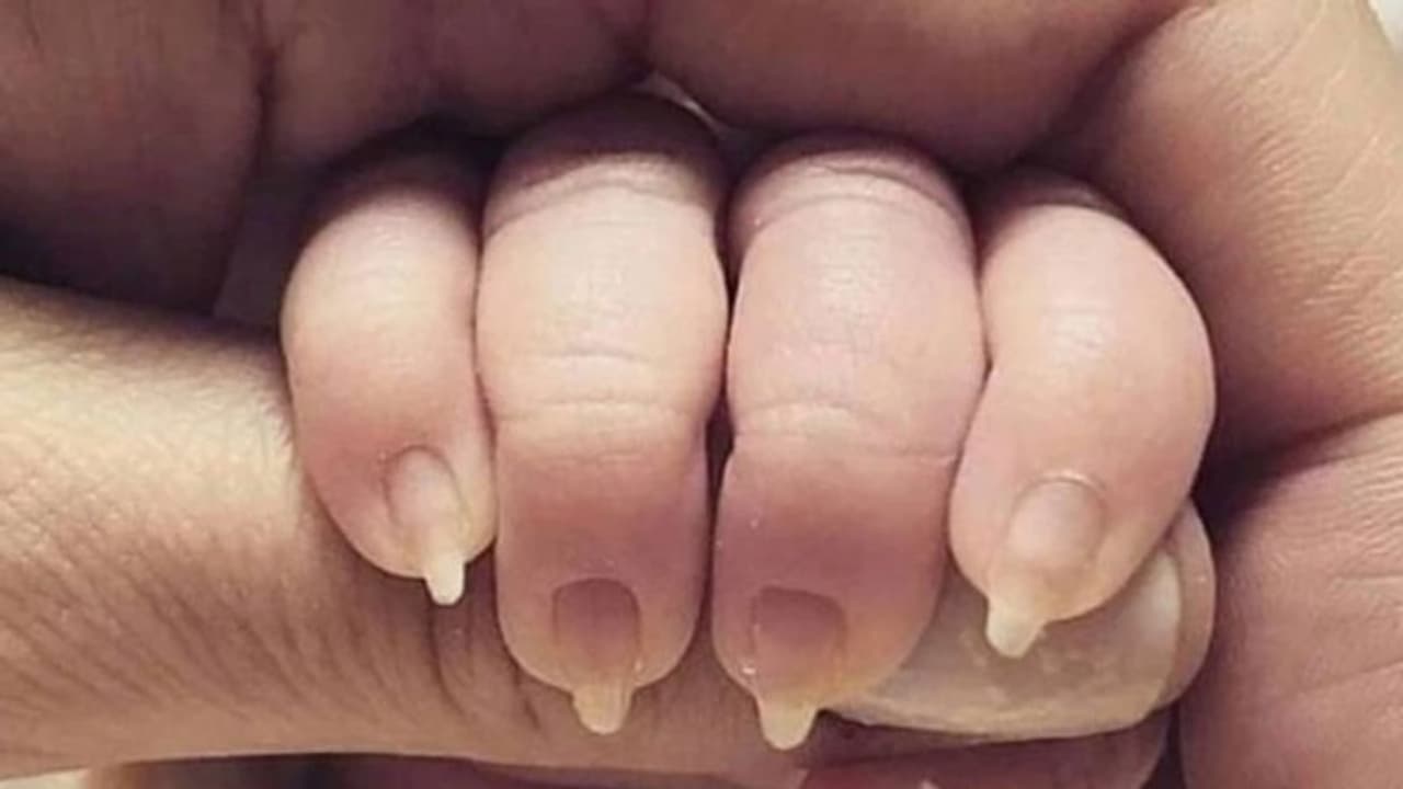 നവജാതശിശുവിന് 'മാനിക്യൂര്'; വിവാദമായി അമ്മ പോസ്റ്റ് ചെയ്ത ഫോട്ടോ നവജാതശിശുവിന് 'മാനിക്യൂര്'; വിവാദമായി അമ്മ പോസ്റ്റ് ചെയ്ത ഫോട്ടോ