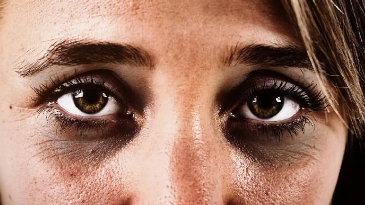 കണ്ണിന് ചുറ്റുമുള്ള കറുപ്പകറ്റാൻ വീട്ടിലുണ്ടാക്കാം കിടിലനൊരു ജെല്‍!