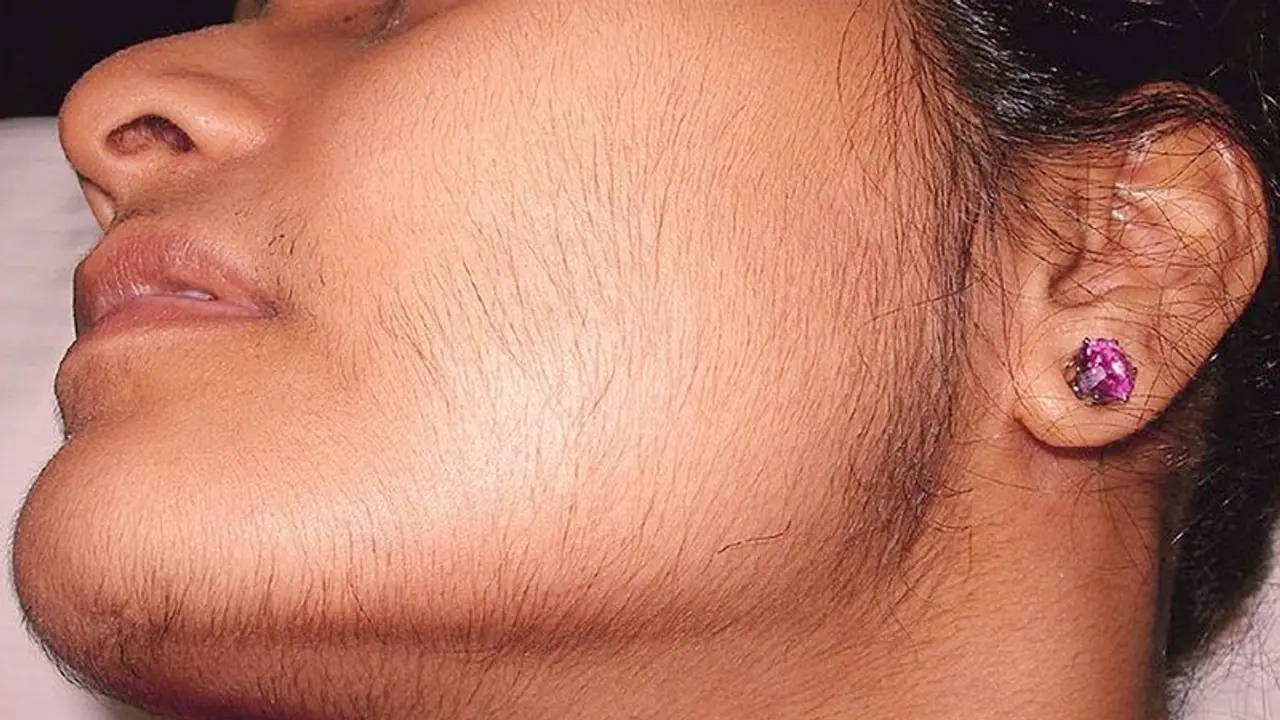 মুখের অবাঞ্ছিত লোম নিয়ে অস্বস্তিতে ভোগেন, পার্লারের খরচ বাঁচিয়ে কাজে লাগান এই উপাদান মুখের অবাঞ্ছিত লোম নিয়ে অস্বস্তিতে ভোগেন, পার্লারের খরচ বাঁচিয়ে কাজে লাগান এই উপাদান