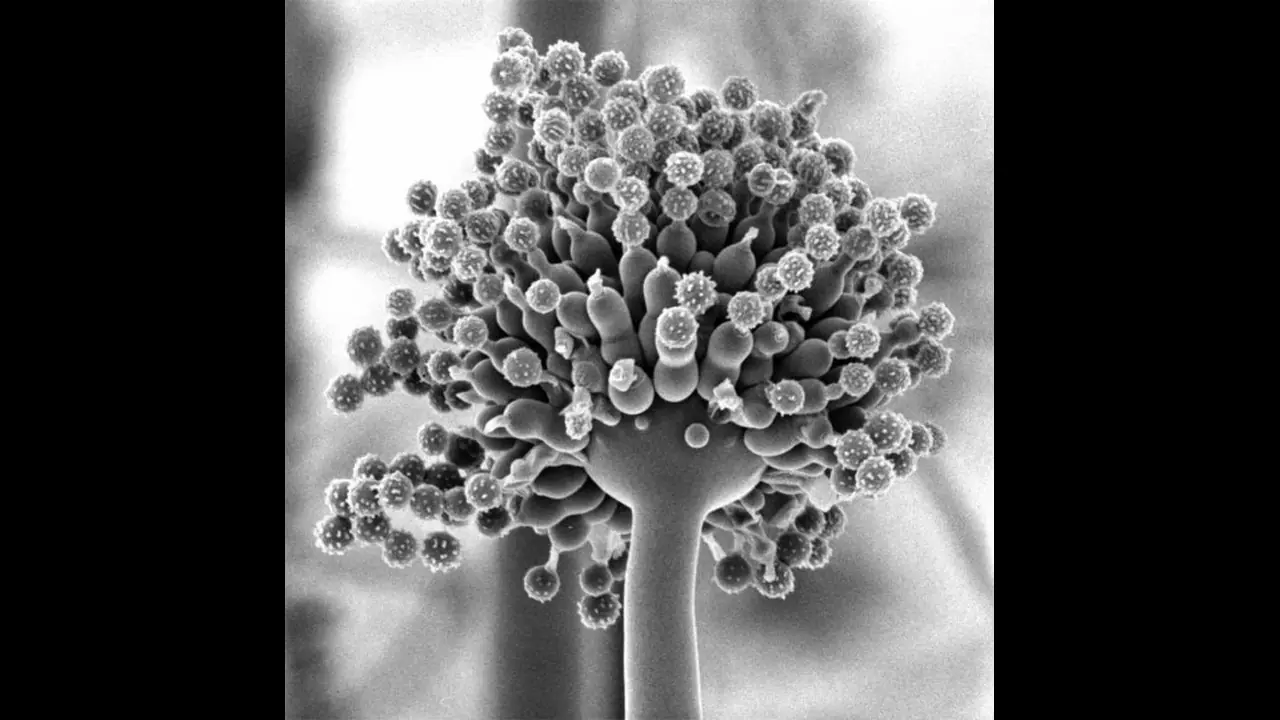 Maharashtra government declares Mucormycosis or ‘black fungus’ as notified disease