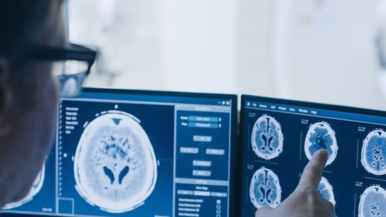 കൊവിഡ് 19 തലച്ചോറിനേയും ബാധിക്കുന്നു!; കണ്ടെത്തലുമായി ഗവേഷകര് കൊവിഡ് 19 തലച്ചോറിനേയും ബാധിക്കുന്നു!; കണ്ടെത്തലുമായി ഗവേഷകര്