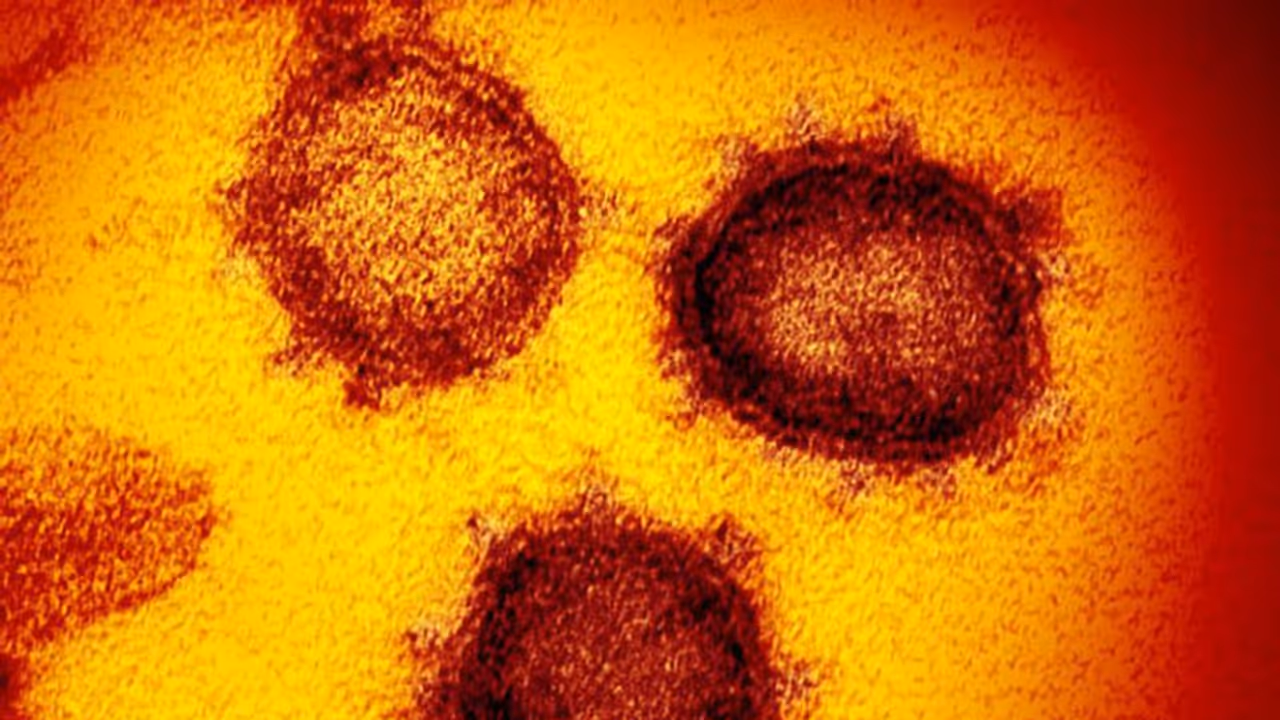 Britain returnee tests positive for COVID 19, Bengaluru under scare, sample sent to NIMHANS Britain returnee tests positive for COVID 19, Bengaluru under scare, sample sent to NIMHANS