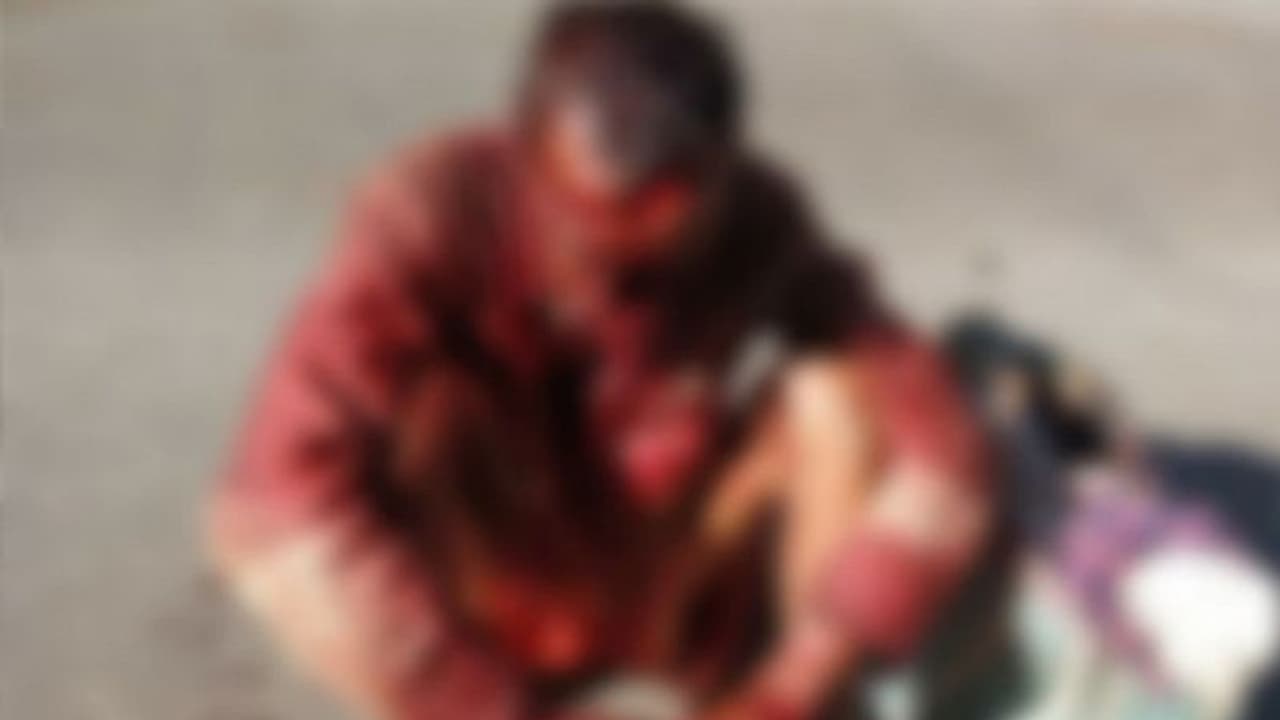 छत्तीसगढ़ में आदमखोर भालू बुजुर्ग का मुंह नोचकर खा गया, आंख और नाक आ गए बाहर..तड़प तड़पकर हुई मौत छत्तीसगढ़ में आदमखोर भालू बुजुर्ग का मुंह नोचकर खा गया, आंख और नाक आ गए बाहर..तड़प तड़पकर हुई मौत