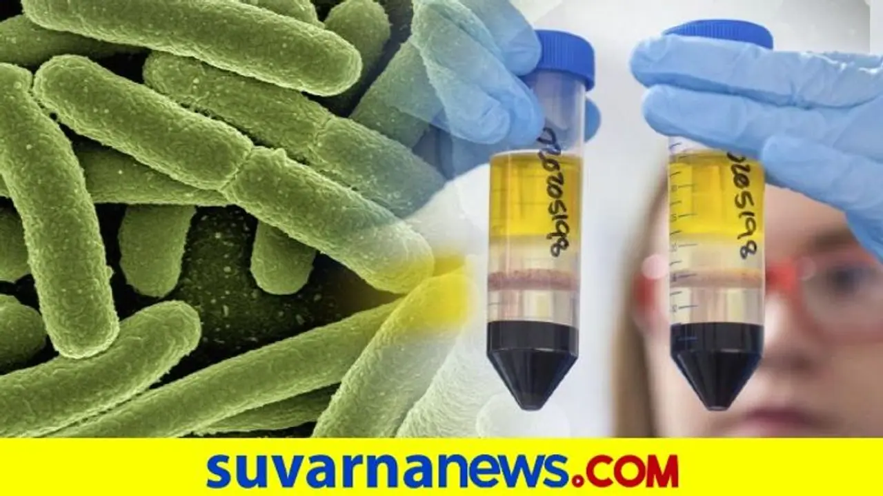 ಮಾಡೆರ್ನಾ ಲಸಿಕೆ ಪಡೆದ ಅಮೆರಿಕ ವೈದ್ಯನಿಗೆ ಗಂಭೀರ ಅಲರ್ಜಿ ಮಾಡೆರ್ನಾ ಲಸಿಕೆ ಪಡೆದ ಅಮೆರಿಕ ವೈದ್ಯನಿಗೆ ಗಂಭೀರ ಅಲರ್ಜಿ