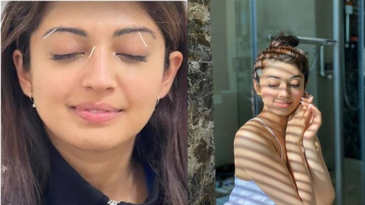 వైరల్ ఫొటో : మొహానికి సూదులతో ప్రణీత వైరల్ ఫొటో : మొహానికి సూదులతో ప్రణీత