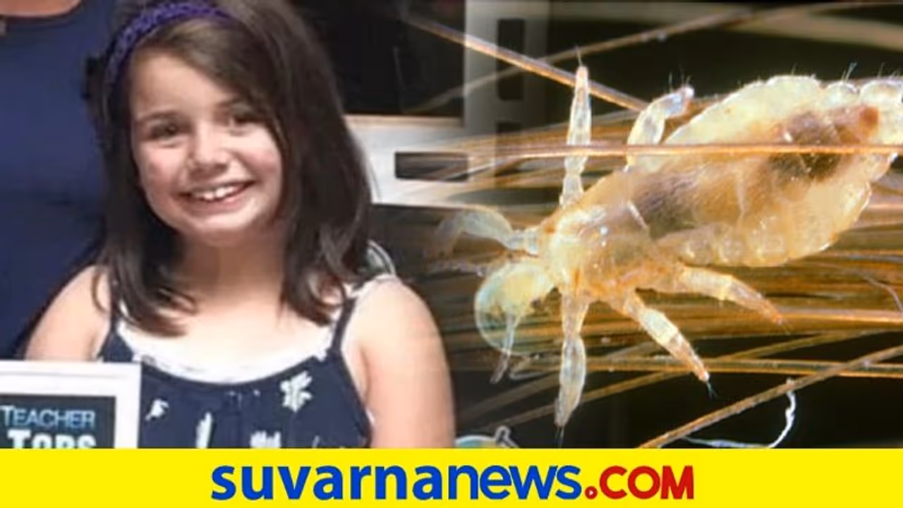 ಹೇನು ಕಚ್ಚಿಯೇ ಸತ್ತಳು 12ರ ಹುಡುಗಿ: ಪೋಷಕರು ಜೈಲಿಗೆ ಹೇನು ಕಚ್ಚಿಯೇ ಸತ್ತಳು 12ರ ಹುಡುಗಿ: ಪೋಷಕರು ಜೈಲಿಗೆ