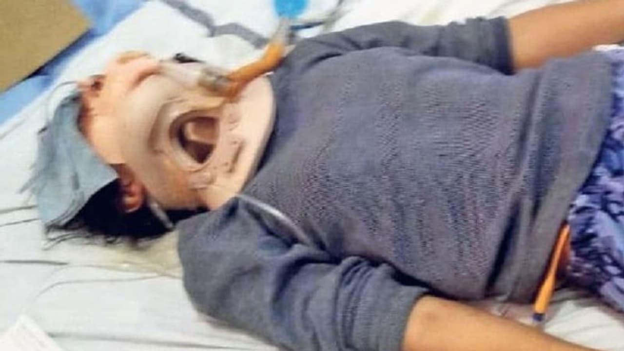 जिसे चाचा कहती उसी ने बच्ची का किया रेप, गला गर्दन और कान में डले टांके..पेट और सिर से बह रहा खून जिसे चाचा कहती उसी ने बच्ची का किया रेप, गला गर्दन और कान में डले टांके..पेट और सिर से बह रहा खून