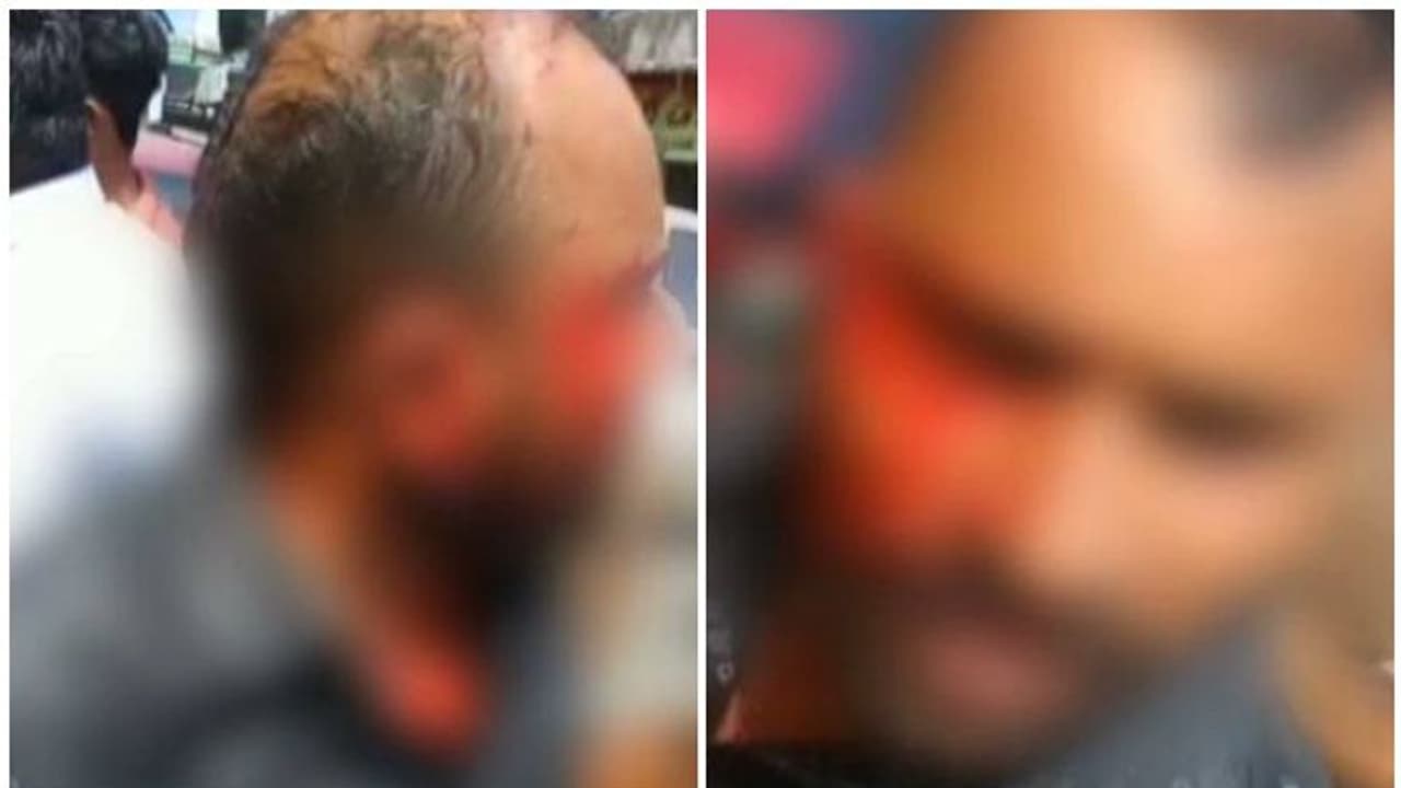 യുവാവിനെ കസ്റ്റഡിയില് എടുക്കുന്നതിൽ തര്ക്കം; ഈരാറ്റുപേട്ടയിൽ പൊലീസും നാട്ടുകാരും തമ്മിൽതല്ല് യുവാവിനെ കസ്റ്റഡിയില് എടുക്കുന്നതിൽ തര്ക്കം; ഈരാറ്റുപേട്ടയിൽ പൊലീസും നാട്ടുകാരും തമ്മിൽതല്ല്