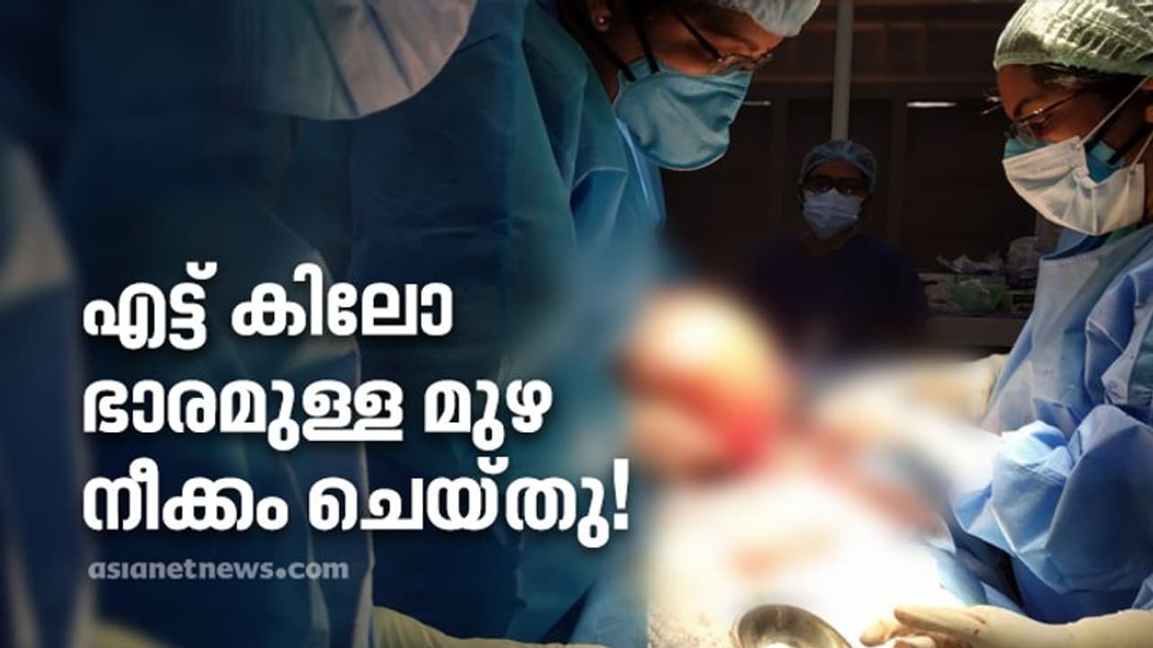 64 കാരിയുടെ വയറ്റിൽ നിന്ന് നീക്കം ചെയ്തതത് എട്ട് കിലോ തൂക്കമുള്ള മുഴ; ശസ്ത്രക്രിയ തിരുവനന്തപുരം എഎസ്എടിയിൽ 64 കാരിയുടെ വയറ്റിൽ നിന്ന് നീക്കം ചെയ്തതത് എട്ട് കിലോ തൂക്കമുള്ള മുഴ; ശസ്ത്രക്രിയ തിരുവനന്തപുരം എഎസ്എടിയിൽ