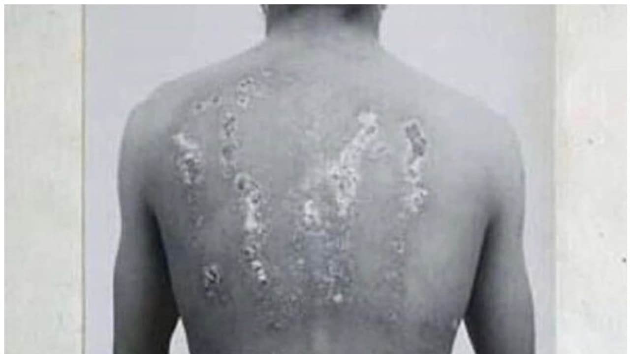 ഇന്ത്യൻ സൈനികരുടെമേൽ ബ്രിട്ടൻ നടത്തിയ ക്രൂരമായ രാസായുധ പരീക്ഷണങ്ങൾ... ഇന്ത്യൻ സൈനികരുടെമേൽ ബ്രിട്ടൻ നടത്തിയ ക്രൂരമായ രാസായുധ പരീക്ഷണങ്ങൾ...