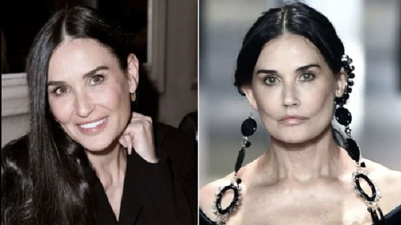 'പ്ലാസ്റ്റിക് സര്‍ജറി ദുരന്തമാണോ?'; പ്രമുഖ നടിയുടെ ചിത്രങ്ങള്‍ വൈറലാകുന്നു