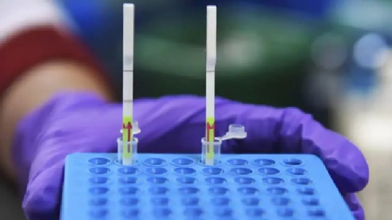 ಬಾವಲಿಯಿಂದ ಮನುಷ್ಯನಿಗೆ ಹರಡಬಲ್ಲ ಹೊಸ HKU5 CoV 2 ಕೊರೋನಾ ವೈರಸ್ ಪತ್ತೆ