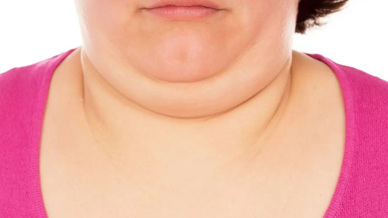 কৌশল করে ঢেকে ফেলুন ডবল চিন, রইল কয়টি সহজ টোটকা, মুহূর্তে পাবেন নিখুঁত চোয়াল কৌশল করে ঢেকে ফেলুন ডবল চিন, রইল কয়টি সহজ টোটকা, মুহূর্তে পাবেন নিখুঁত চোয়াল